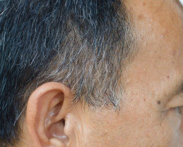 Greying Hair
