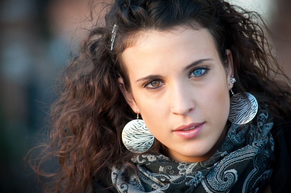 Heterocromia olhos