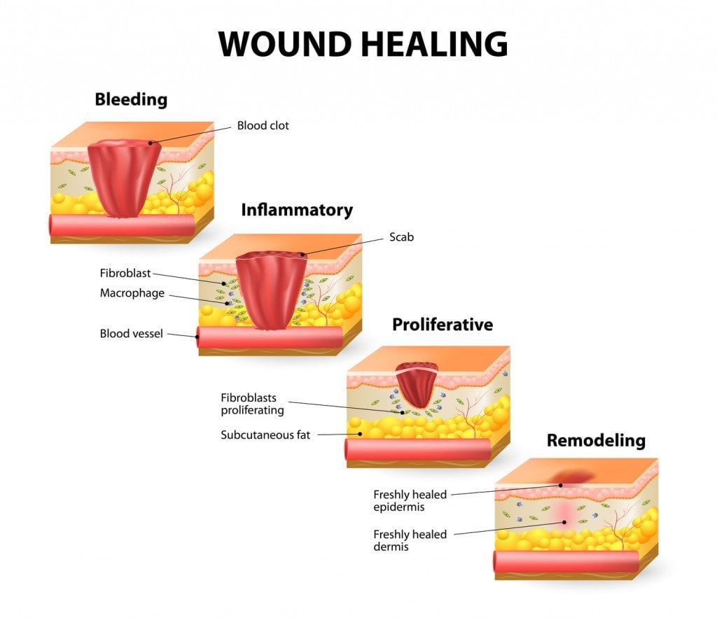 Why Do Healing Wounds Itch? » Science ABC