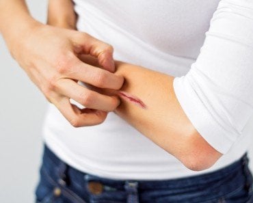 Woman scratching her wound