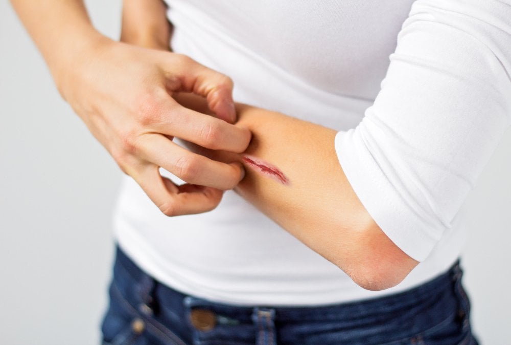 Woman scratching her wound