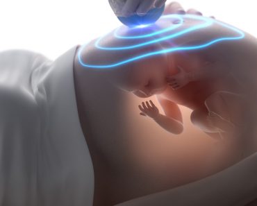 3D ultrasound during pregnancy concept