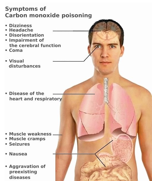 Sintomas de toxicidade de CO