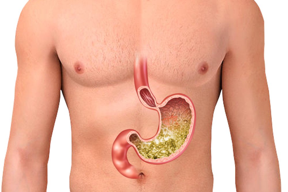 What Is Gastric Acid Stomach Acid Is It Diluted When We Drink Water 