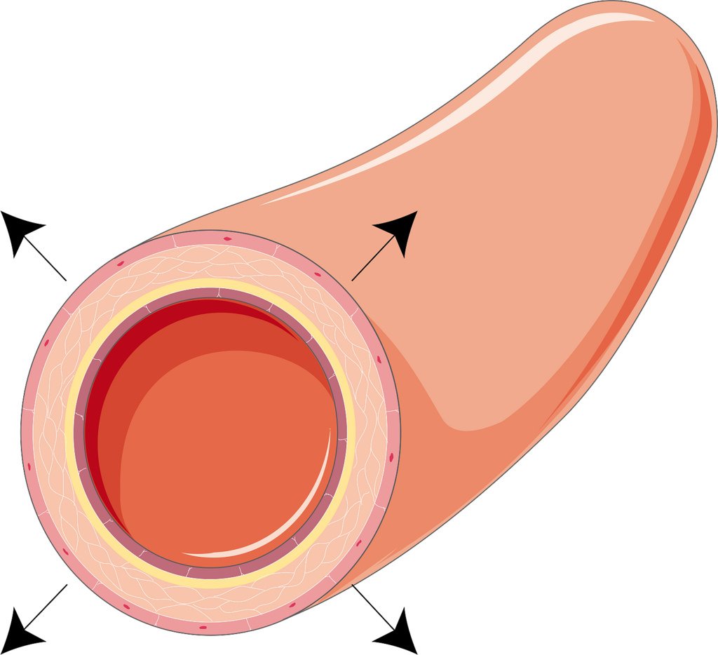 Orthopnea Definition Orthopneic Positions Symptoms Causes Treatment