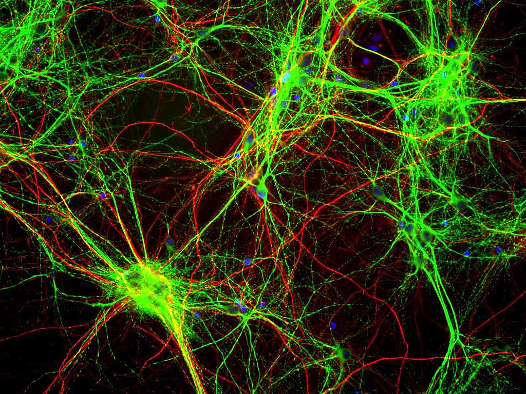 Cultura de células cerebrais de ratos coradas com anticorpo para MAP2 (verde), Neurofilamento (vermelho) e DNA (azul)