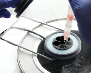 Cryopreserving ovarian tissue strips Cryopreservation Egg freezing
