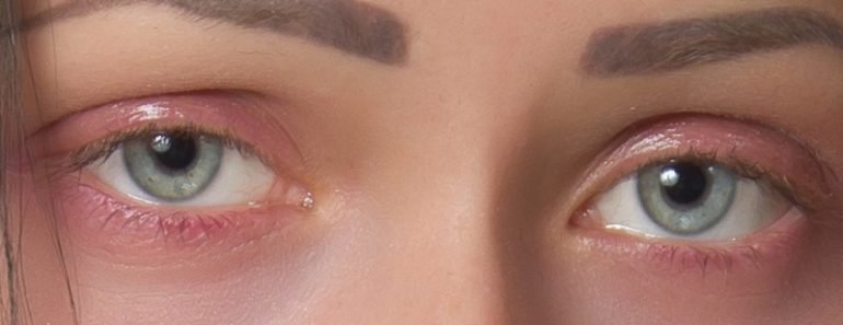 Woman sleepy eyes
