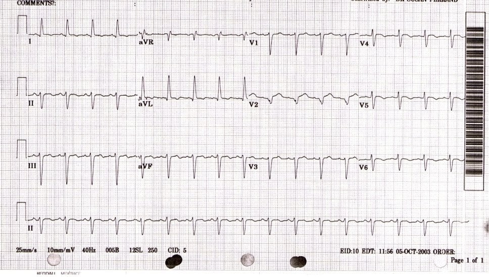 Relatório de ECG