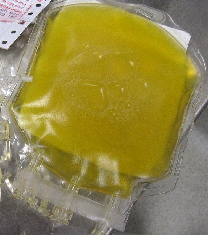 Plasma fresco