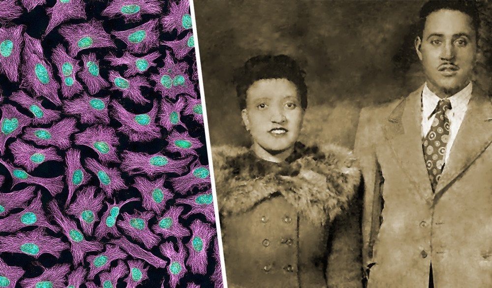 HeLa-III and henrietta lacks and david lacks