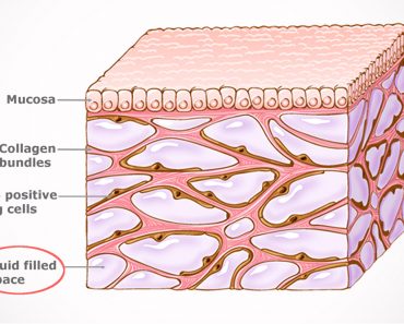 fluid-filled sacs