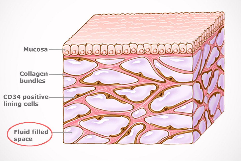 fluid-filled sacs