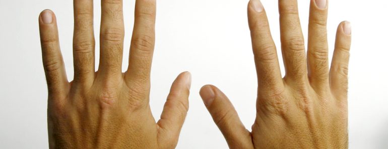 hands