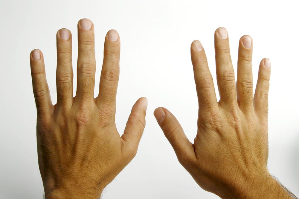 Why are your fingers different lengths