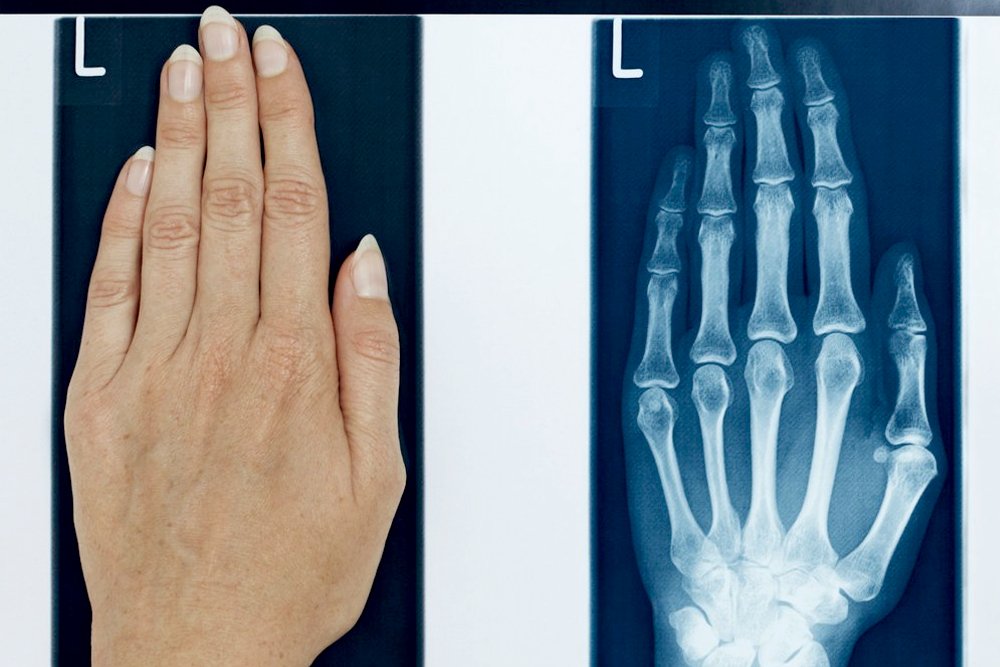 X ray: Definition, Properties, History and Applications