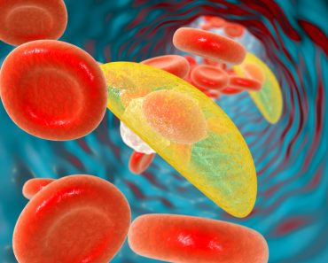 Toxoplasma gondii parasites in blood, the causative agent of toxoplasmosis disease, 3D illustration - Illustration( Kateryna Kon)s