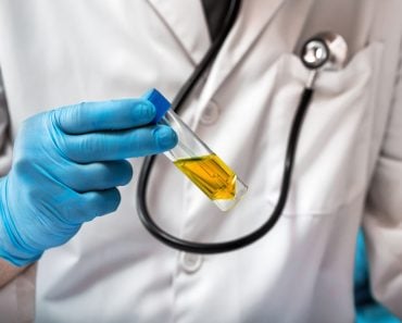 hand of doctor holding urine tube for test in laboratory(angellodeco)S