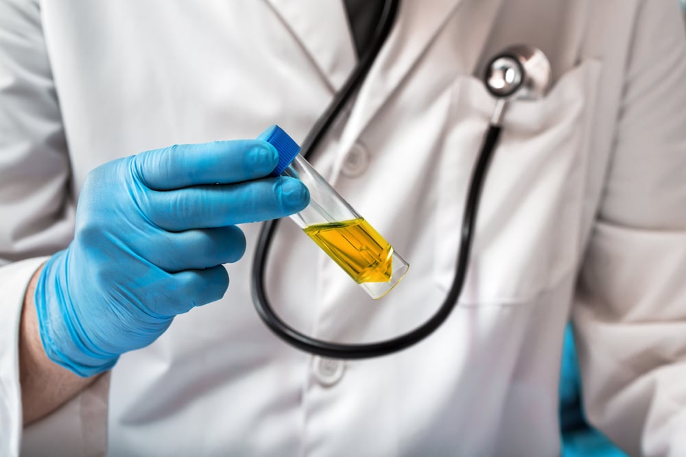 hand of doctor holding urine tube for test in laboratory(angellodeco)S