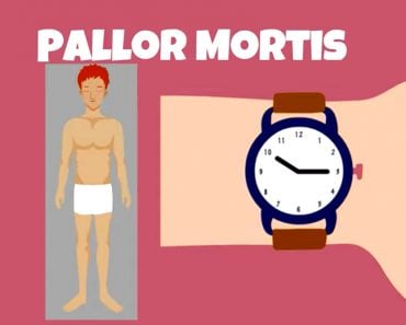 pallor mortis