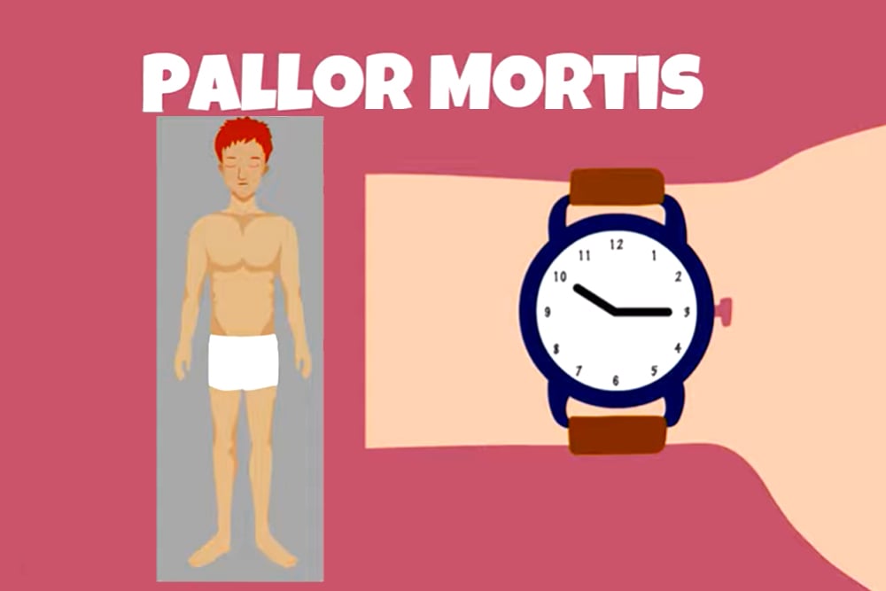 pallor mortis