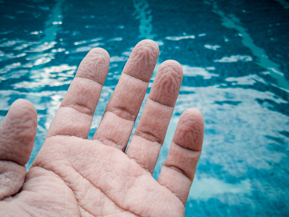 wrinkled hand because of soak in the water for a long time(SharkPaeCNX)S