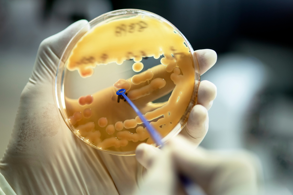 Klebsiella,Pneumoniae,Colonies;,Close,Up,The,Media,Plate,On,Hand