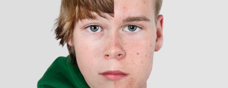 Serious,Boy,Merge,To,Teen,Headshot,Half,Side,By,Side