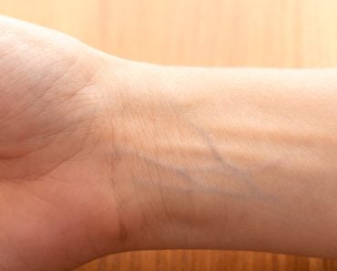 Human,Wrist,With,Blue,Veins,Visible,Through,Skin,Close,Up