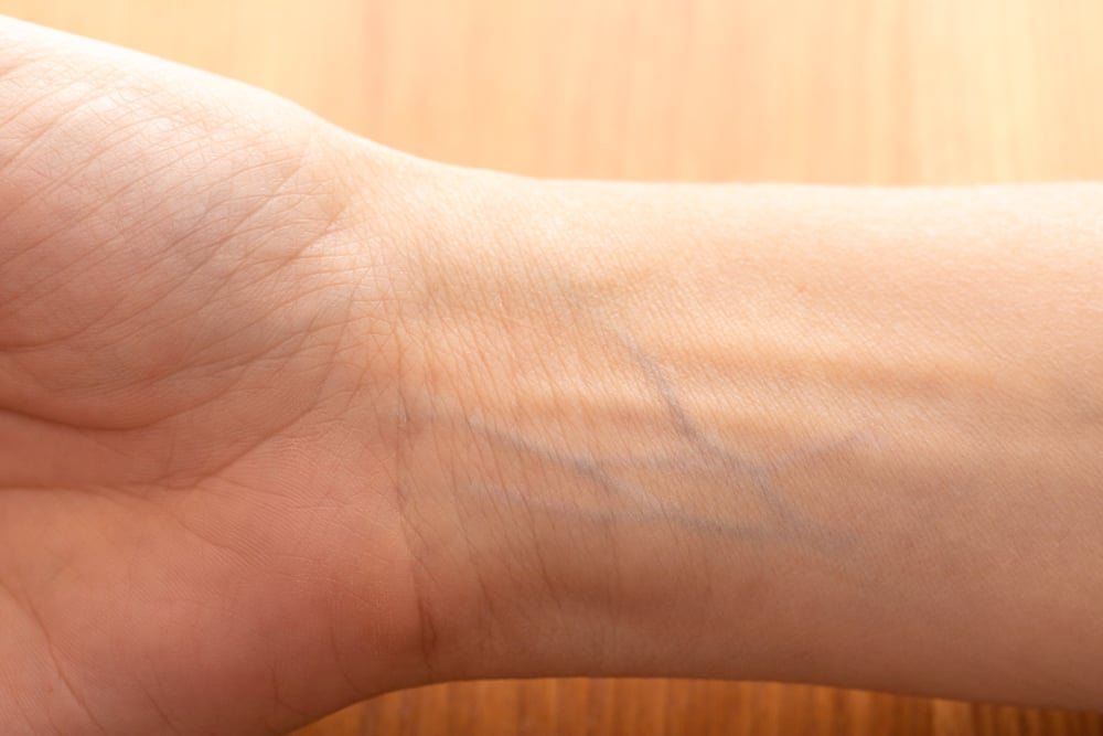 Human,Wrist,With,Blue,Veins,Visible,Through,Skin,Close,Up