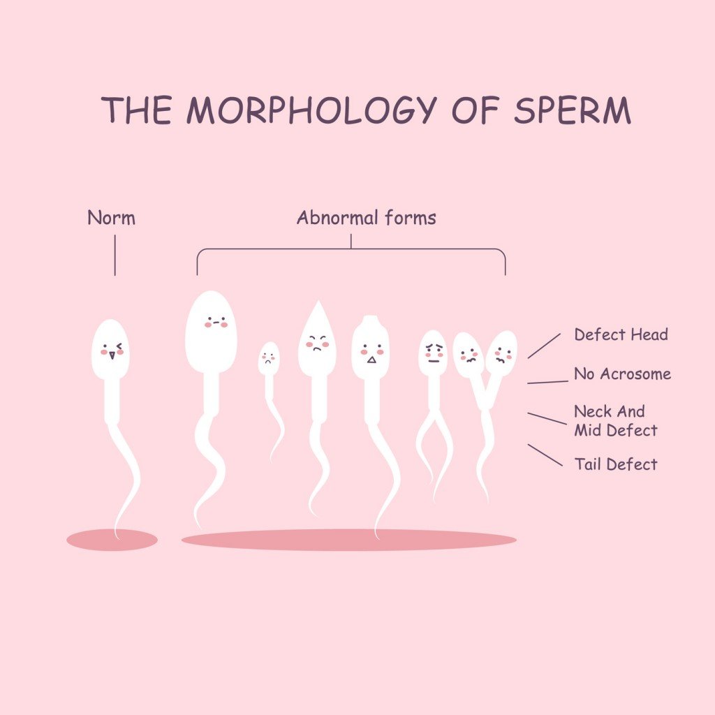 Sperm Morphology (Photo Credit: etoileark / Fotolia)