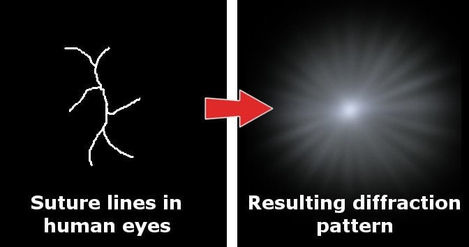effect of eyes' suture lines on diffraction pattern star shape