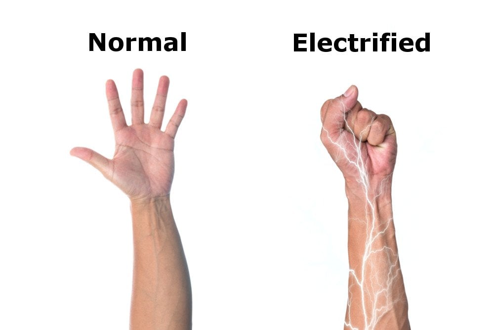 Electrified arm