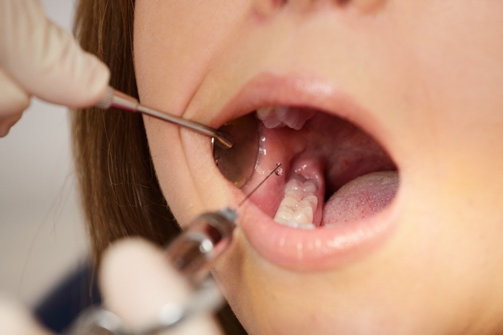 Dentist making anaesthetic injection to patient tooth