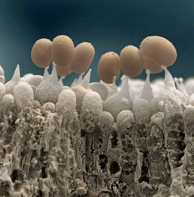 Magnified Image of Mushroom Spore