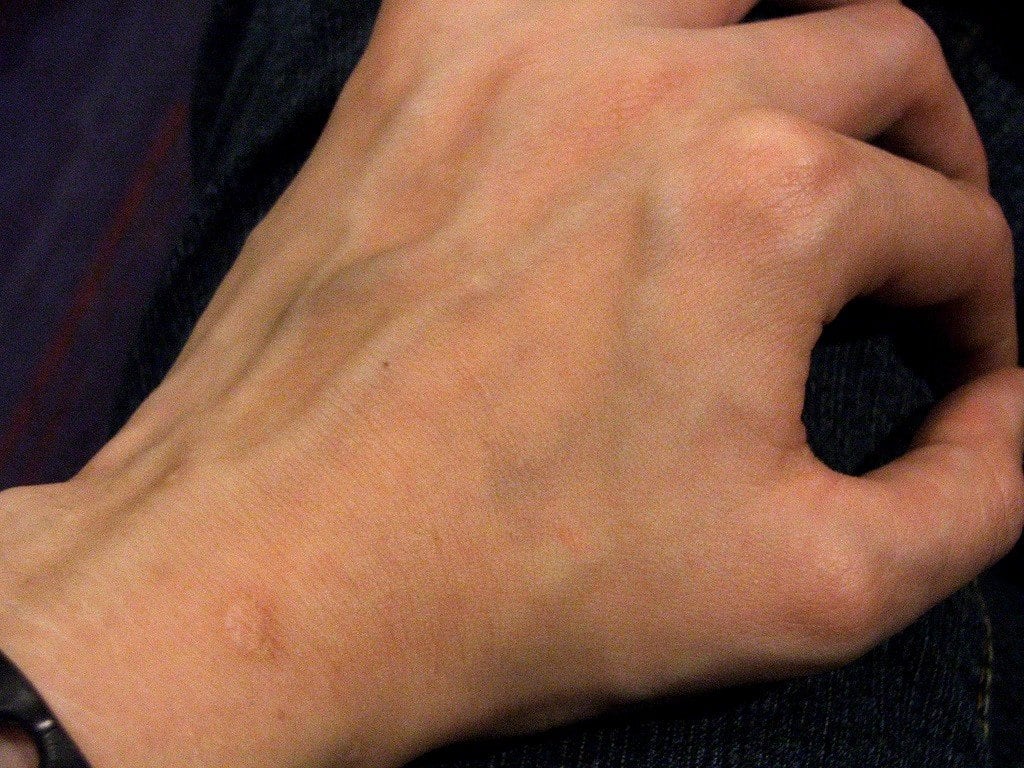 Man hand blood vein