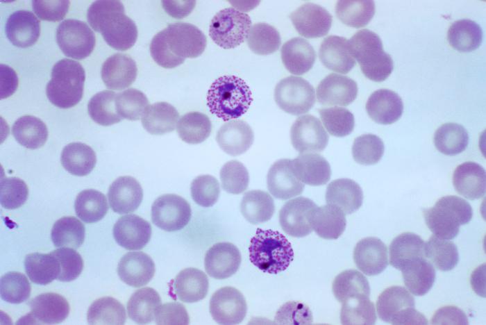 Immature and mature trophozoites of the Plasmodium vivax parasite PHIL 2720 lores