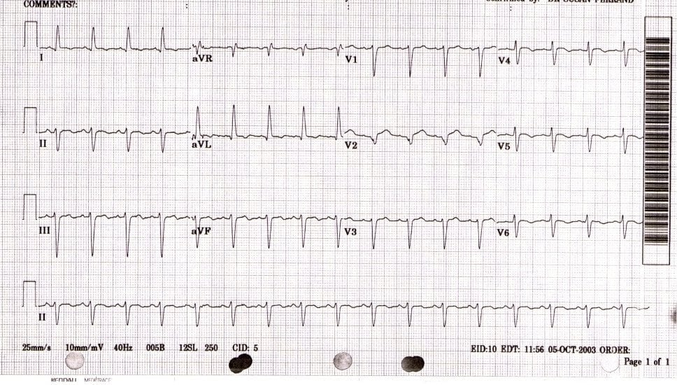 ECG report