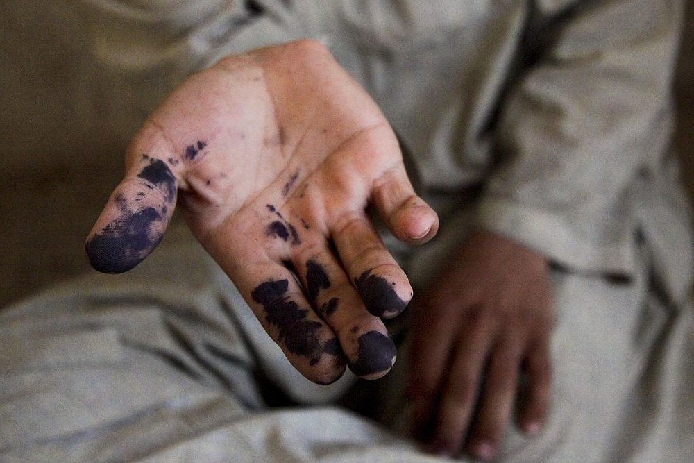 Ink stain on hand