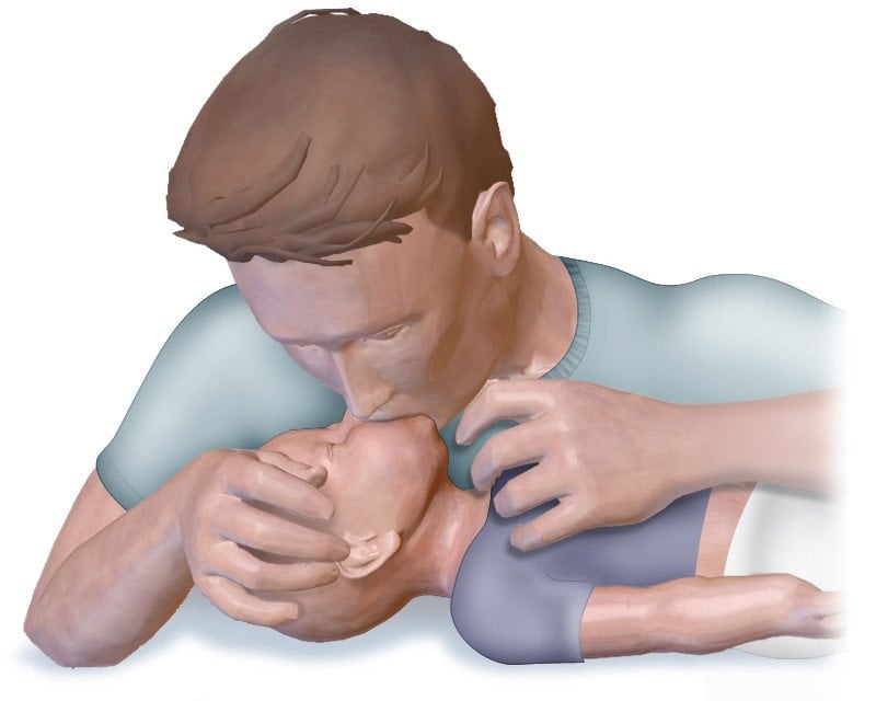 CPR Infant Mouth To Nose