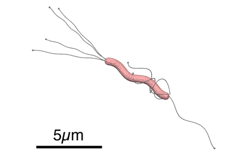 Helicobacter pylori