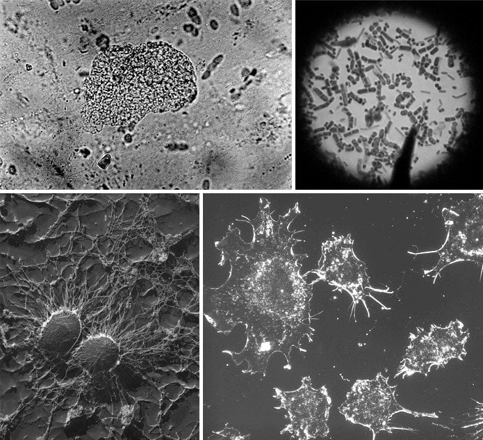 Microscope result black & white