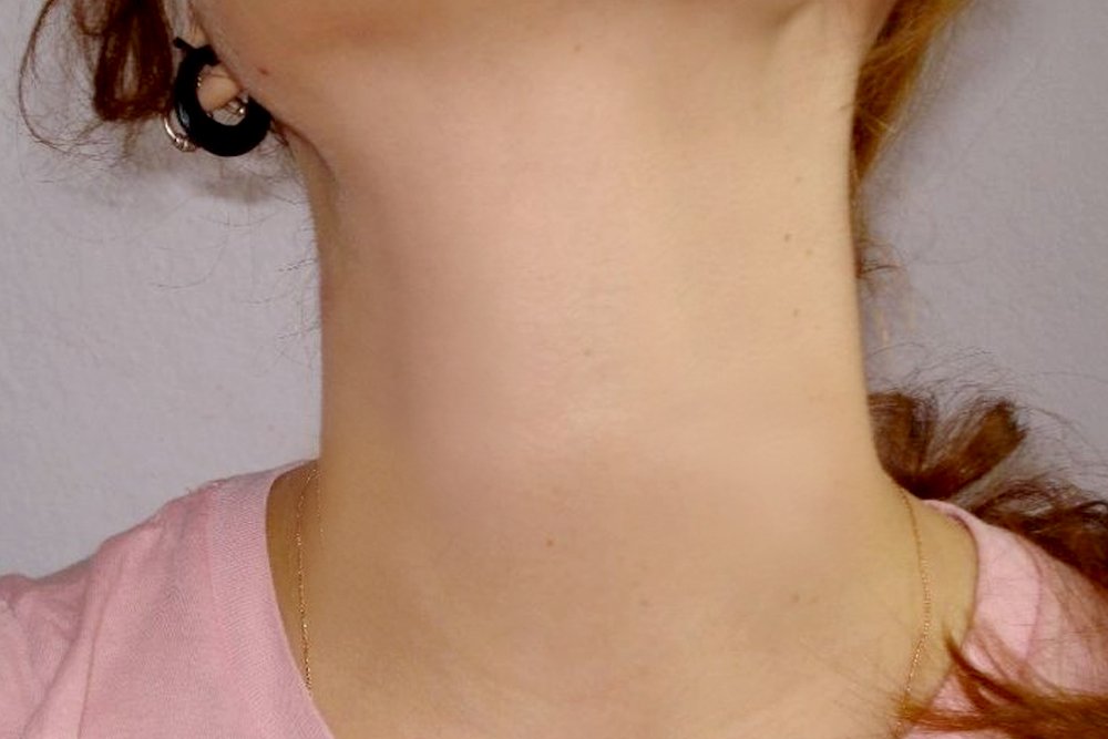 neck