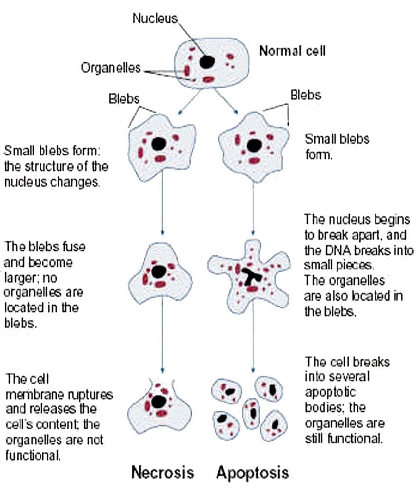 necrosis vs apoptosis