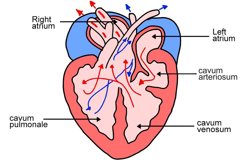 three chamber heart