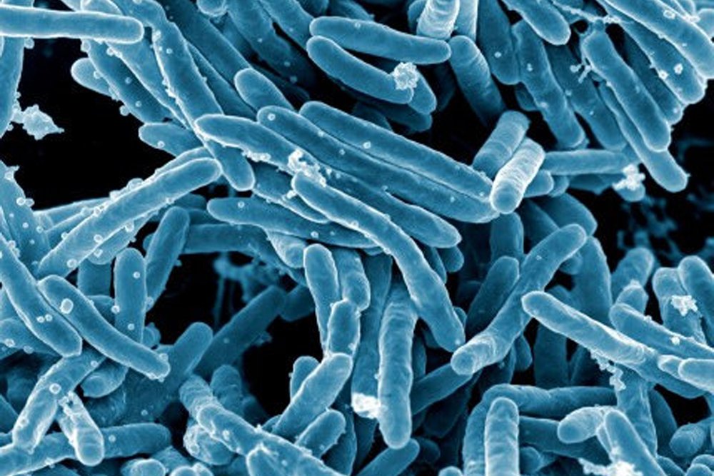 Mycobacterium tuberculosis