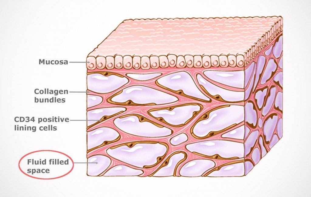 fluid-filled sacs