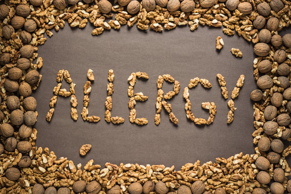 The word allergy is written from the walnuts on a dark brown paper background in a frame of walnuts. View from above. Allergy food concept - Image( Andriana Syvanych)s