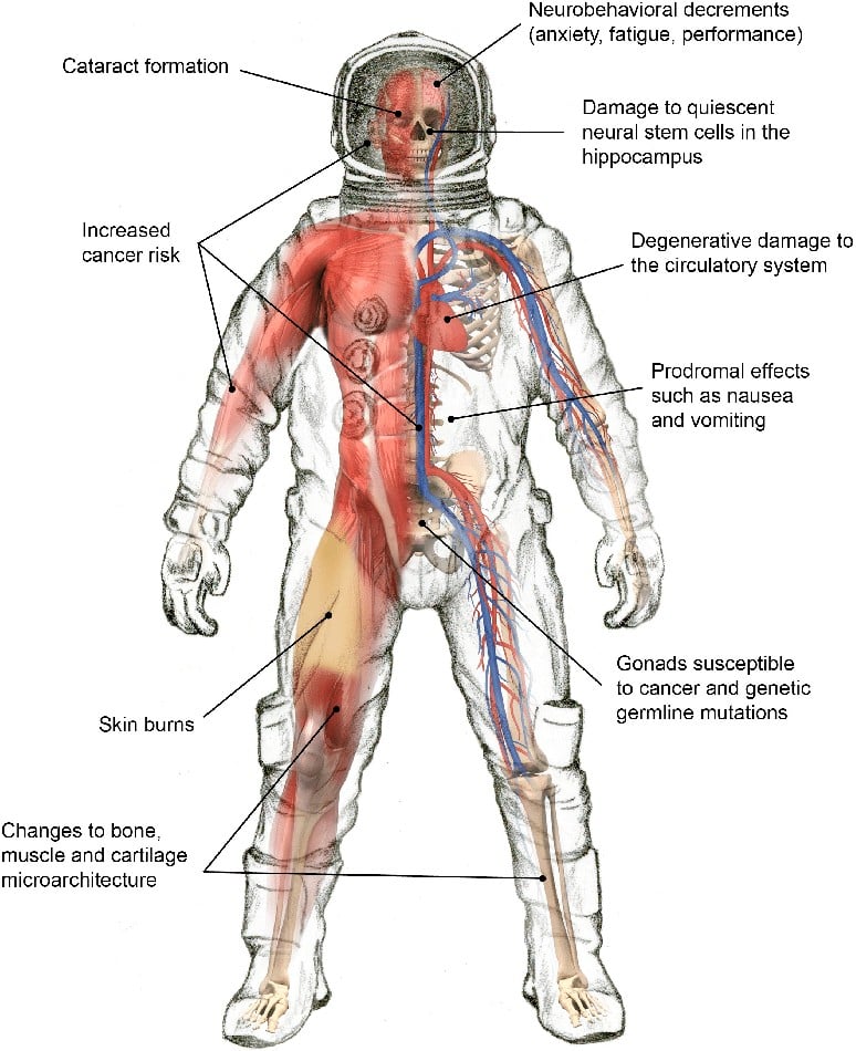 select health effect due to space radiation exposured