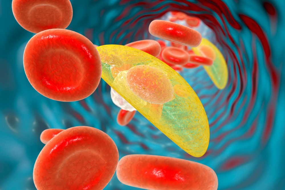 Toxoplasma gondii parasites in blood, the causative agent of toxoplasmosis disease, 3D illustration - Illustration( Kateryna Kon)s